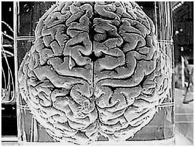 Аутичный мозг менее гибок в выполнении задач