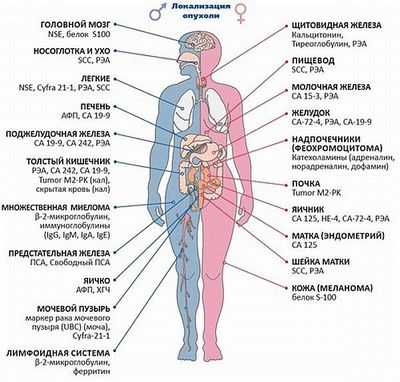 Микрожидкостная технология выявляет потенциальный биомаркер раннего рака поджелудочной железы