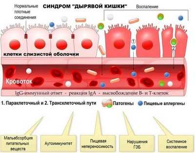 Стратегии уменьшения бактериальной колонизации