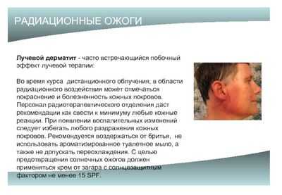 Кожные реакции во время лучевой терапии можно предотвратить