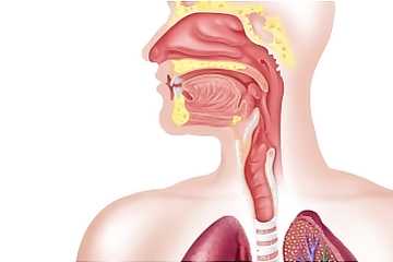 Новая стадия рака ротоглотки, связанного с ВПЧ