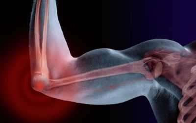 При травмах, связанных с качкой, локоть соединен с бедром