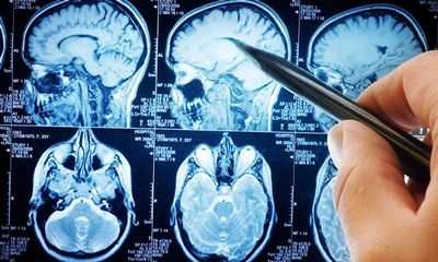 Новая биомедицинская диагностика с использованием персонализированной 3D-визуализации