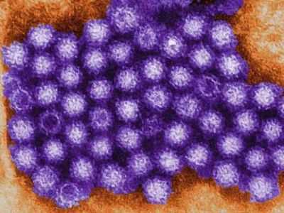 Норовирусы распространяются по воздуху на несколько метров: вирусы, вызывающие 50% гастроэнтеритов