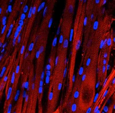 Первая сокращающаяся человеческая мышца, выращенная в лаборатории