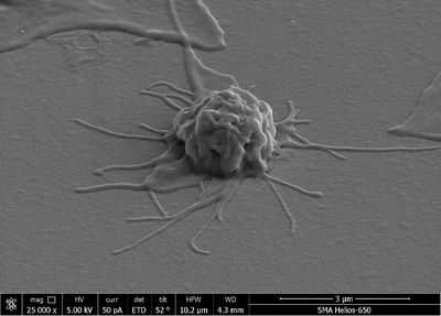 Инъекции богатой тромбоцитами плазмы могут улучшить заживление тканей