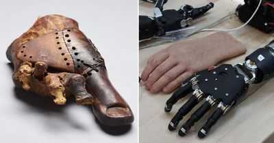 Ампутанты вошли в историю, управляя двумя модульными протезами конечностей