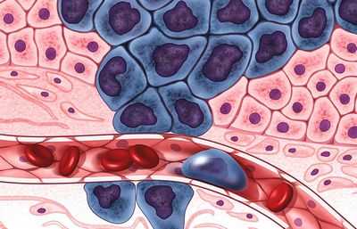 Исследование проливает новый свет на агрессивный рак у детей