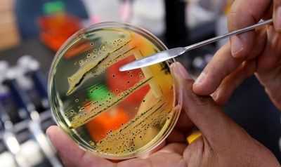 Остерегайтесь кухонных комбайнов: биопленки сальмонеллы невероятно устойчивы к сильнодействующим дезинфицирующим средствам