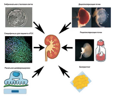 ИПСК перспективны для лечения почек