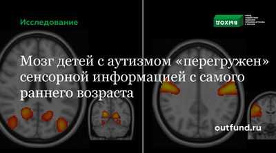 Исследование показывает, что однократный спрей окситоцина улучшает работу мозга у детей с аутизмом