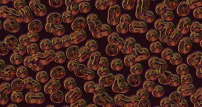 Пережить атаку микробов-убийц