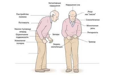 Притормозить болезнь Паркинсона
