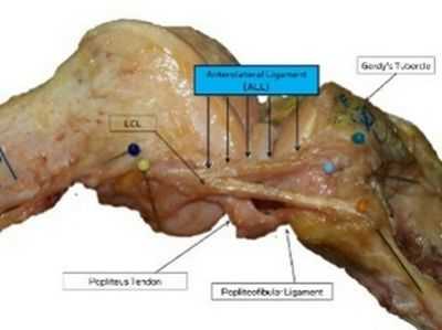 Хирурги описали новую связку в колене человека
