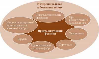 Интерстициальное заболевание легких является значительным фактором риска воспаления легких