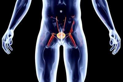 Ожирение значительно увеличивает риск рака простаты у афроамериканских мужчин