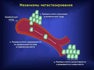 Почему метастазирование рака толстой кишки всегда происходит по одному и тому же инвазивному образцу