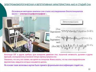 Нарушения сна: 3D-видеомониторинг с интеллектуальным программным обеспечением в качестве новой возможности анализа