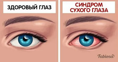 Обычный антибиотик может бороться с сухостью глаз
