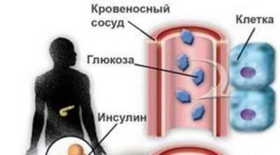 Пожилой возраст в начале диабета 1 типа, связанный с более поздней связью с мозгом