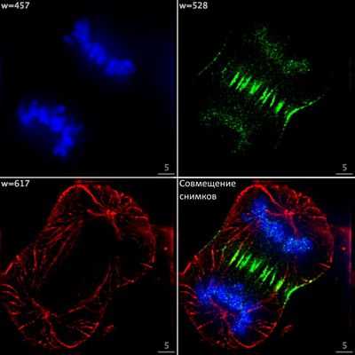 На пути к светящимся в темноте опухолям: новый флуоресцентный зонд может выявить рак