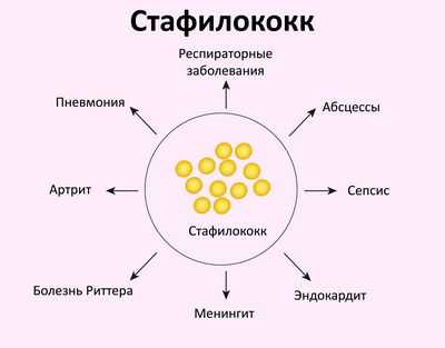 Более быстрый и дешевый способ обнаружить стафилококк в организме