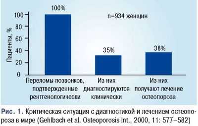 Здоровье населения: исследование в Индиане обнаружило снижение показателей лечения остеопороза