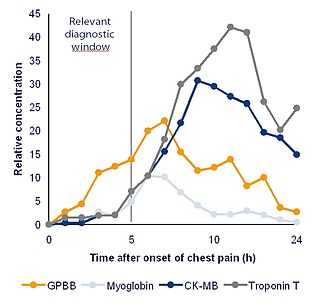 Два биомаркера предсказывают повышенный риск &laquo;тихого&raquo; инсульта
