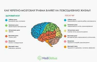 Изучение системы подвешивания мозга при ЧМТ