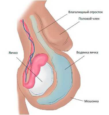Неопустившееся яичко: рекомендованная операция выполняется слишком поздно