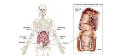 Уровень колоректального рака растет среди молодых людей: исследователи обнаружили, что рак более распространен у тех, кто диагностирован до 50 лет