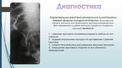 Рентген протоков во время операции на желчном пузыре не связан со снижением риска повреждения общего протока